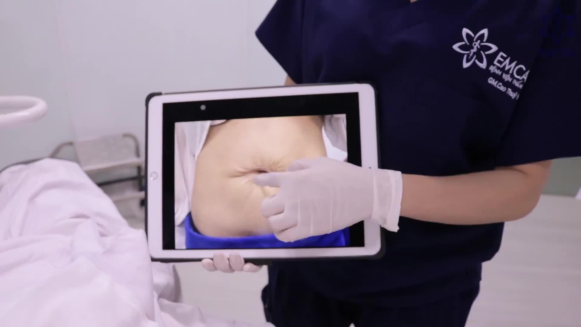 TÁI TẠO THÀNH BỤNG - TẠO ĐIỂM NHẤN QUYẾN RŨ SAU 90 PHÚT