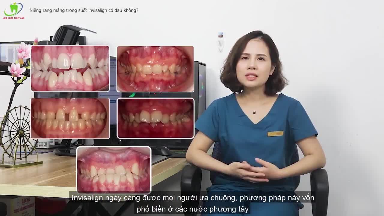 NIỀNG RĂNG MÁNG TRONG SUỐT INVISALIGN CÓ THỰC SỰ ĐAU?
