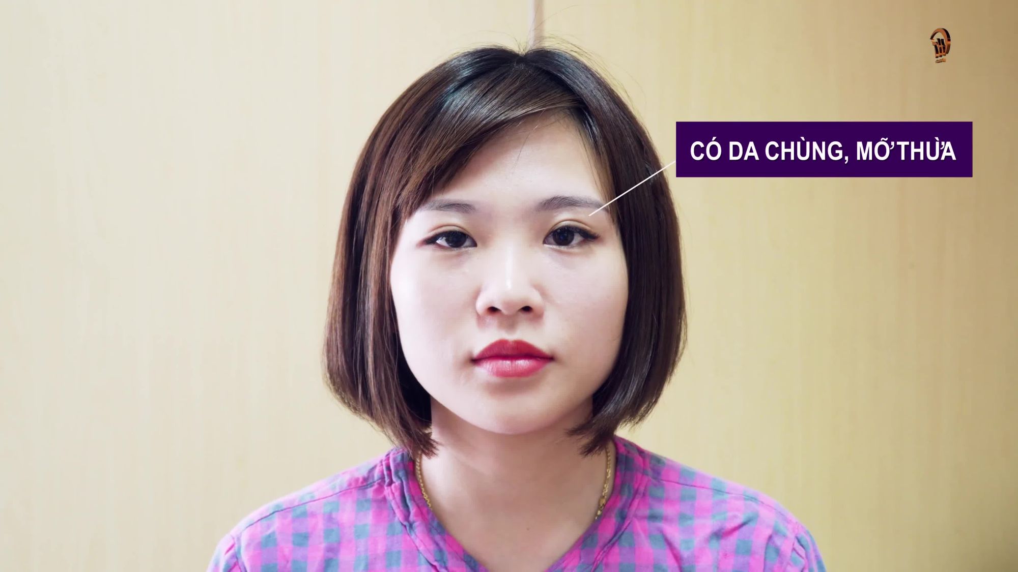 Bác sĩ rất có duyên với các ca mí sửa đấy cả nhà ạ