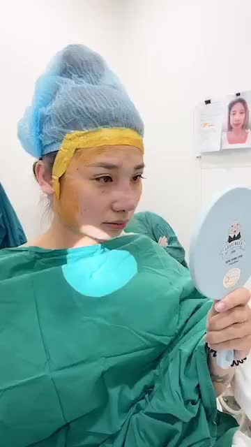Khách hàng đã từng nâng mũi nhân tạo, sóng mũi to và lệch, cánh mũi bè, sóng mũi gồ, đầu mũi ngắn.