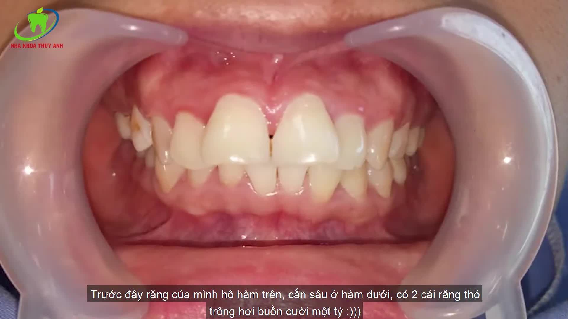 KHOẢNG CÁCH LÀ KHÔNG XA NẾU CHÚNG TA CẦN NHAU