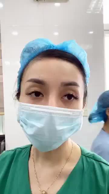 Hút tuyến mồ hôi với công nghệ Vaser Lipo, cải thiện mùi mồ hôi khó chịu vùng nách.
