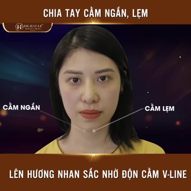 ĐỘN CẰM MỘT LẦN - ĐẸP TRỌN MỘT ĐỜI ‼️