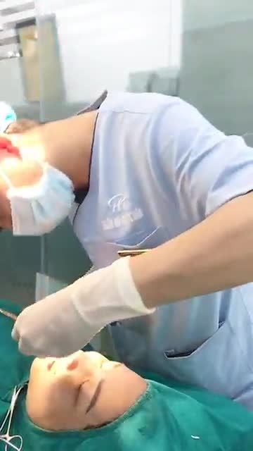 Thứ 7 thư thái, uống một ly trà và ngắm kết quả ca mũi đầu tiền trong ngày của bác sĩ với dịch vụ nâng mũi cấu trúc Pureform nhé