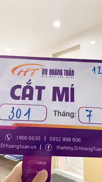 Kết quả ngày sau phẫu thuật cắt mí: Không sưng - Không tím!