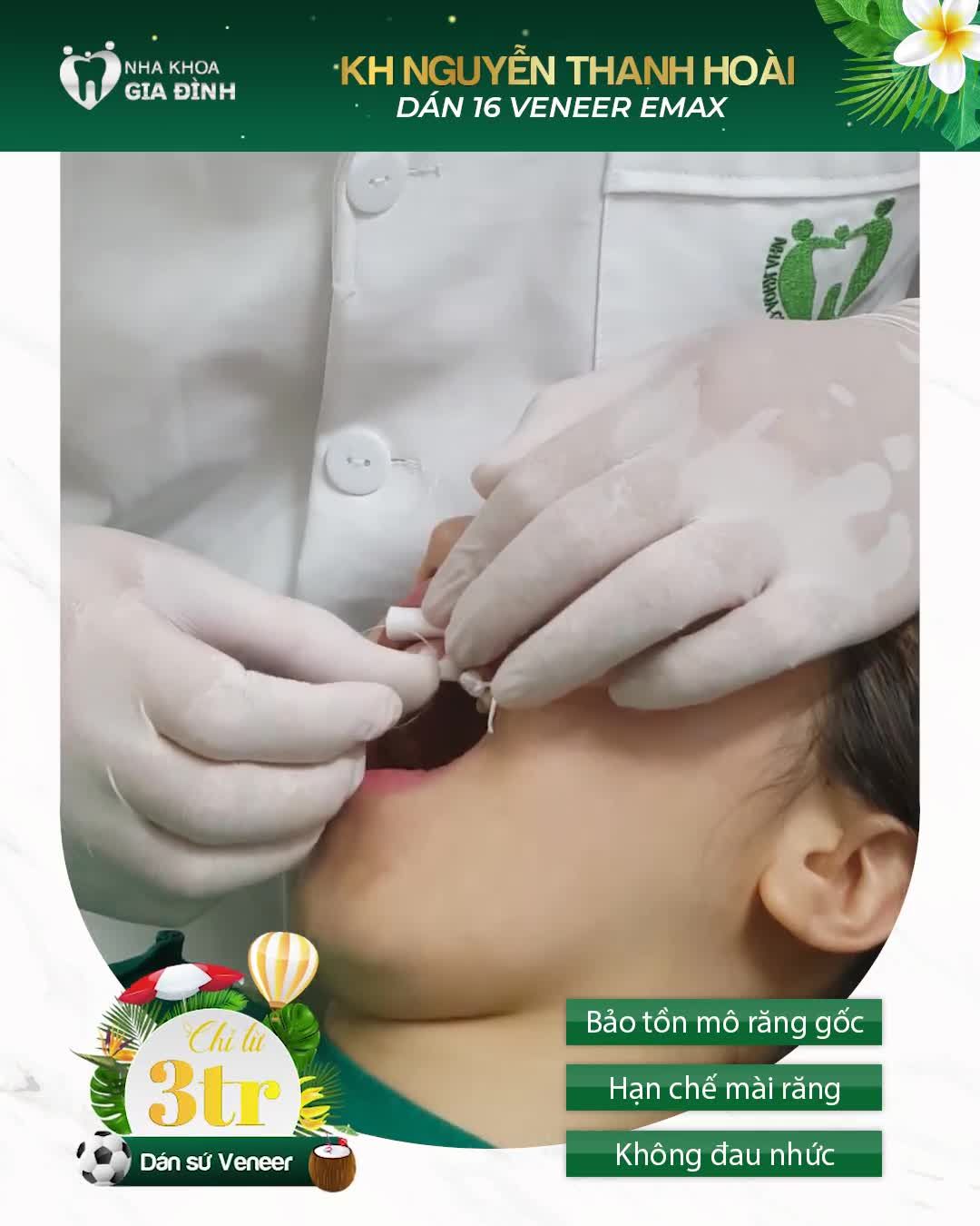 Cùng nghe chị Hoài chia sẻ cảm nhận sau khi sở hữu nụ cười mới từ Nha khoa Gia Đình nhé!