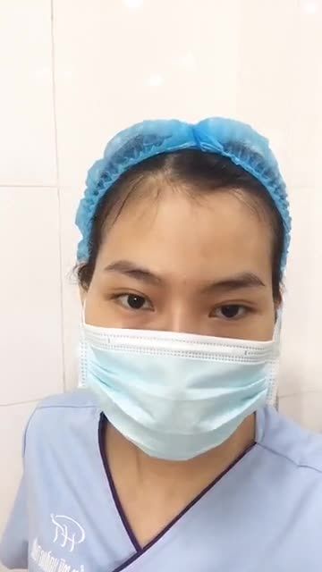 Thêm một bạn gái thay đổi nhan sắc với dịch vụ nâng mũi Sline tại Dr Hoàng Tuấn