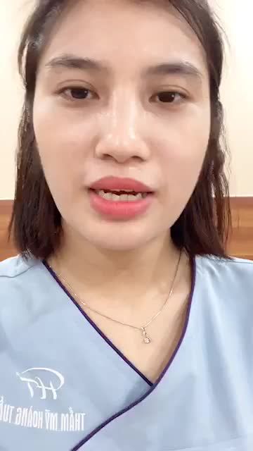 Sẹo lồi vùng cằm - gây mất thẩm mỹ !!!