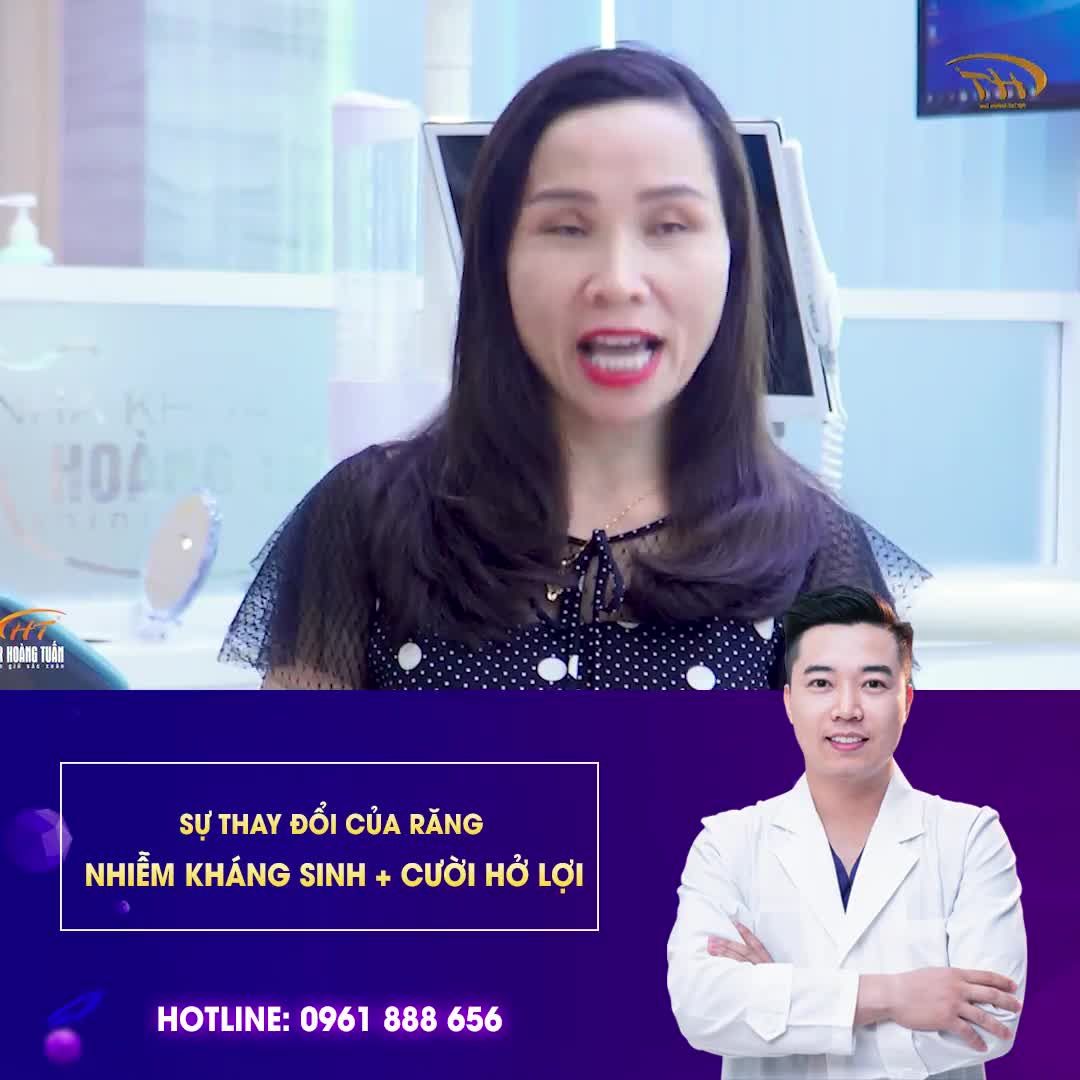 SỰ THAY ĐỔI CỦA KHÁCH HÀNG CÓ HÀM RĂNG NHIỄM KHÁNG SINH NẶNG + CƯỜI HỞ LỢI.