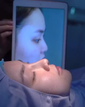 NÂNG MŨI DEMI 5D KHẮC PHỤC ĐẦU MŨI TO, SỐNG MŨI THẤP.