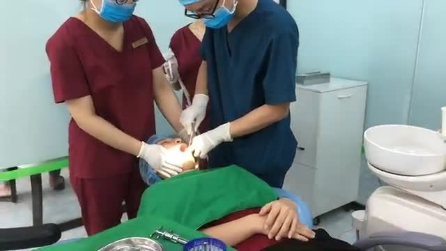 Nhổ răng khôn 37.38 do dắt thức ăn, sâu vỡ phần thân răng tại Nha Khoa Thuỳ Anh.
