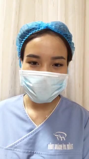 Khắc phục tình trạng mũi thấp, gãy, sống ngắn, đầu mũi tròn và hếch cho khách hàng ca mũi số 136/7 của bác sĩ.