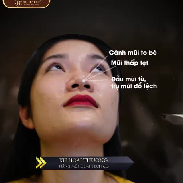 SỞ HỮU DÁNG MŨI THANH TÚ VỚI NÂNG MŨI DEMI TECH 6D‼️