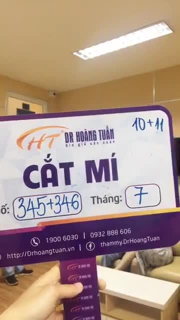 Vừa làm xong dịch vụ cắt mí trên, ưng quá lại tiếp tục đăng ký luôn cắt mí dưới, khách nhà em đáng yêu quá ạ
