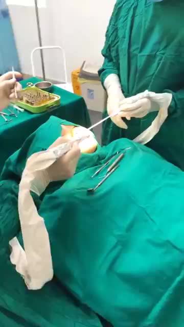 Ca cắm 2 răng Implant chất lượng cao trụ Straussman từ Thuỵ Sĩ, được thực hiện bởi bác sĩ Hải