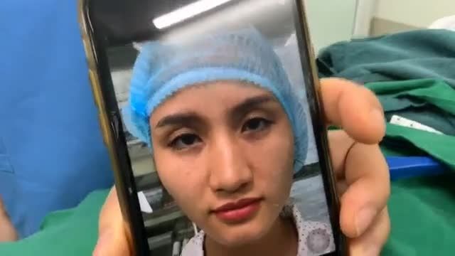 CẮT MÍ VỚI HÕM MẮT LÕM SÂU (do thiếu mỡ)