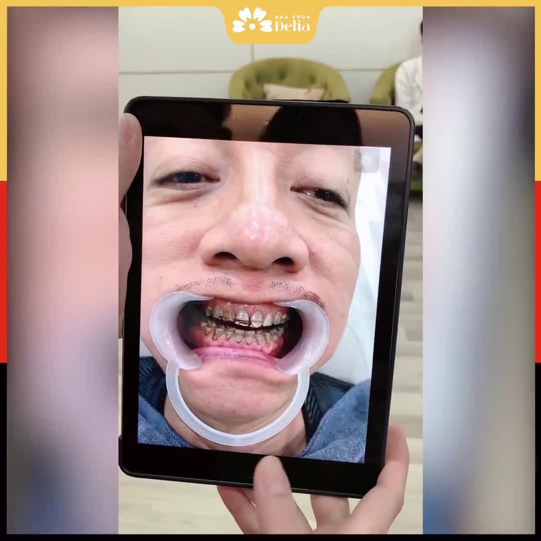 Đã đi nhiều nha khoa nhưng khi đến Delia thì rất bất ngờ bởi tất cả các bác sĩ và nhân viên ở đây....