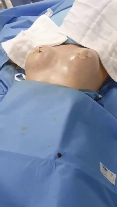 NÂNG NGỰC NỘI SOI TẠI BV QUỐC TẾ ĐẸP NGAY SAU 90 PHÚT