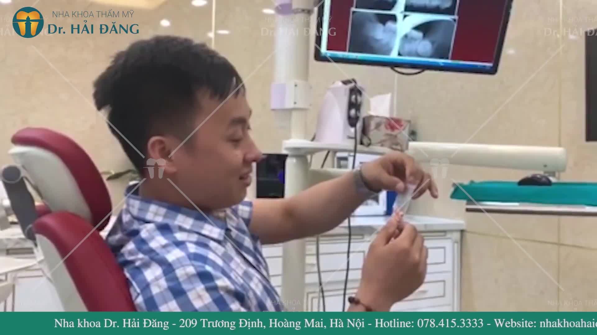 NHỔ RĂNG KHÔN PHỨC TẠP THẾ NÀO