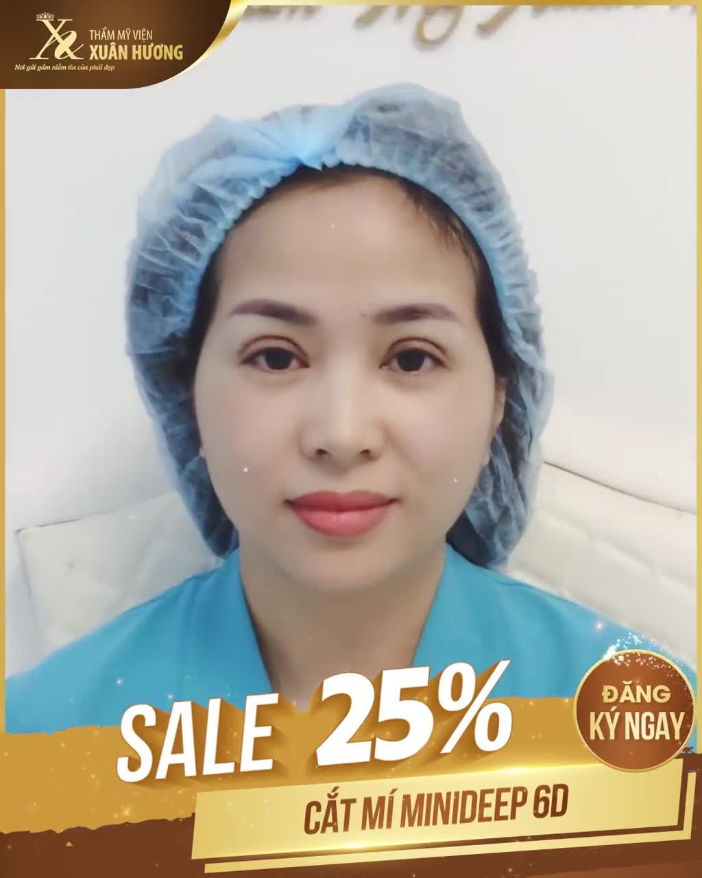 CHỈ CÒN DUY NHẤT 1 NGÀY - ƯU ĐÃI CẮT MÍ MINIDEEP CHỈ 8,4 TRIỆU - NGÀY VÀNG 21/07/2020