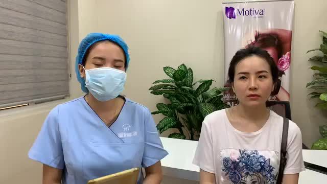 kết quả sau cắt chỉ nâng mũi Sine không sưng, tím và đẹp tự nhiên.