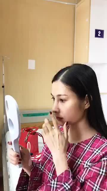 Sống mũi gồ, đầu mũi quặp đã được khắc phục chỉ với nâng mũi Sline của bác sĩ sau 30 phút.