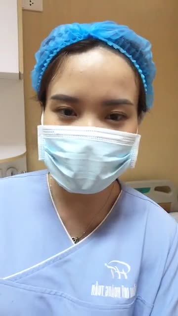 Sở hữu nếp mí rõ ràng, tròn đều ngay sau phẫu thuật, không sưng, không tím một chút nào.