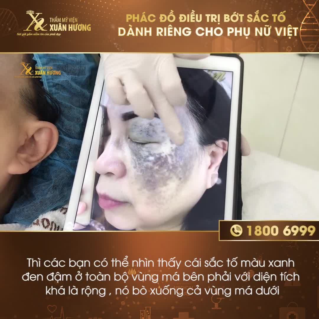TẦM QUAN TRỌNG CỦA VIỆC ĐIỀU TRỊ CHÀM BỚT BẰNG PHÁC ĐỒ RIÊNG BIỆT DÀNH CHO TỪNG KHÁCH HÀNG
