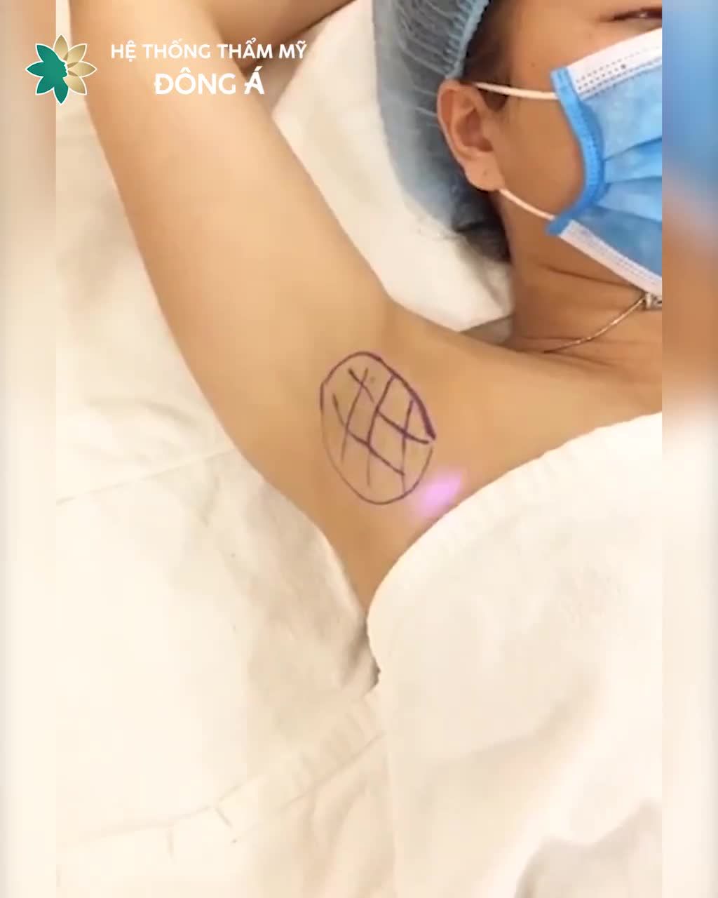 Mùi cơ thể khó chịu Mất tự tin Mặc cảm trước đám đông