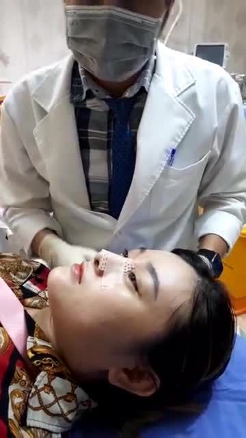 Quy trình thay nẹp mũi sau nâng 5 ngày tại Kanngam