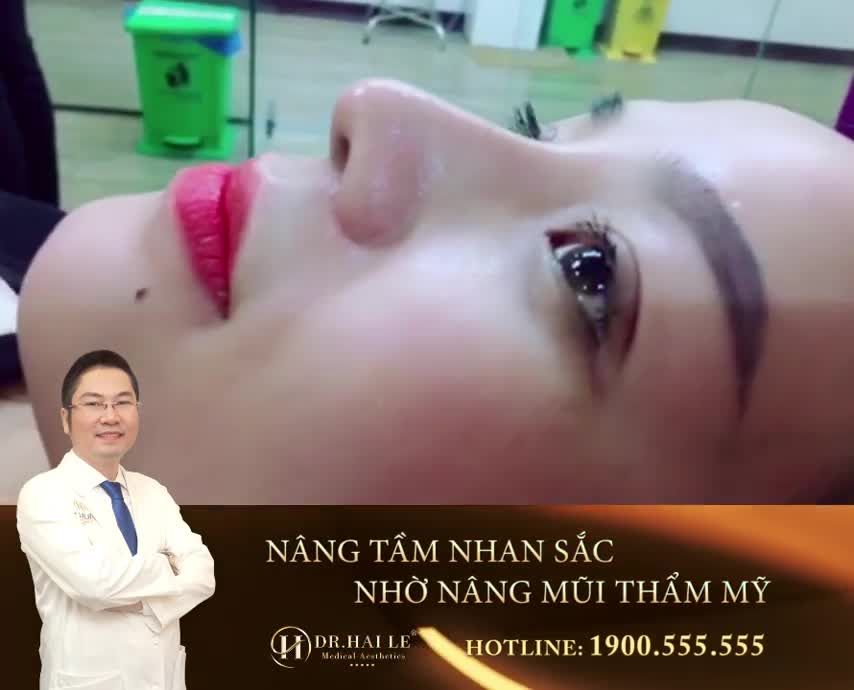 "RINH" NGAY CƠ HỘI NÂNG MŨI 0 ĐỒNG - NHANH TAY KẺO LỠ‼️ Duy nhất: 2 ngày 10,11/07/2020