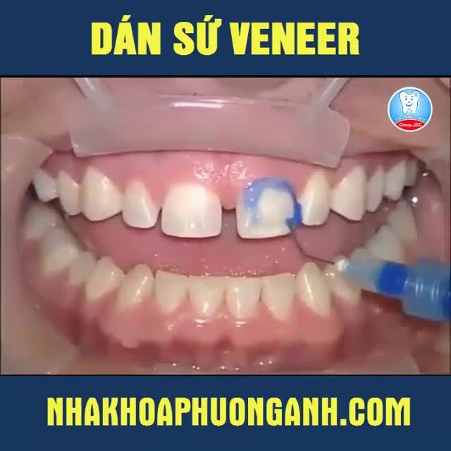 Chỉ cần xem thôi bạn sẽ hiểu