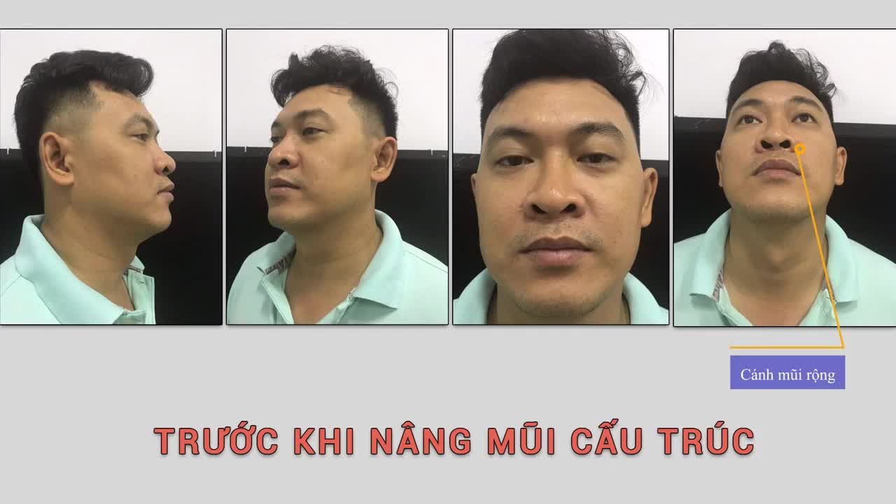 DÁNG MŨI PHONG THUỶ GIÚP CÔNG VIỆC HANH THÔNG VÀ LÀM ĂN THUẬN LỢI. BẠN CÓ TIN KHÔNG?