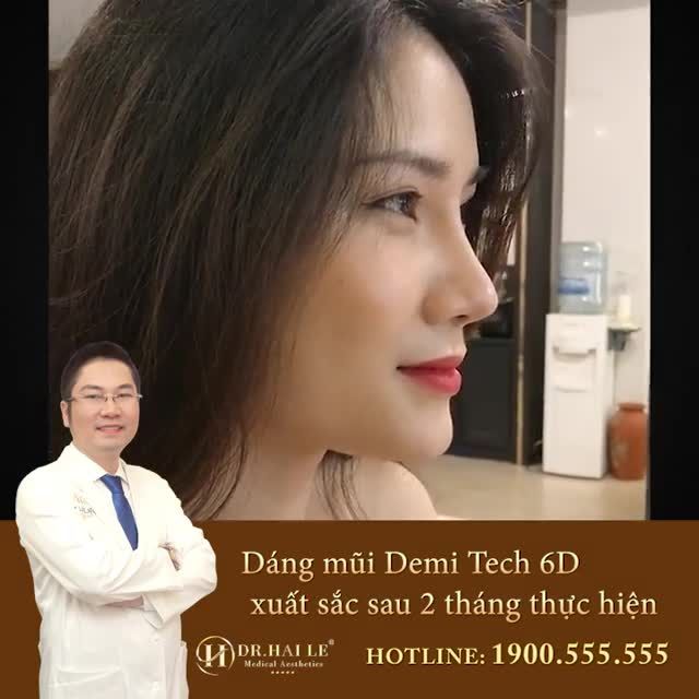Hình ảnh mẹ bỉm sữa HOÀI THƯƠNG sau 2 tháng Nâng mũi Demi Tech 6D  MŨI CAO BAY, ĐẸP BỀN VỮNG!