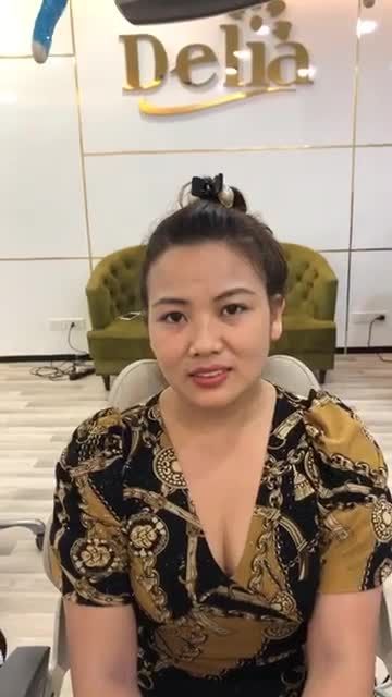 Khách hàng thẩm mỹ răng sứ 2 năm quay lại tái khám : KHÔNG VIÊM LỢI, KHÔNG HÔI MIỆNG,ĂN NHAI BÌNH THƯỜNG