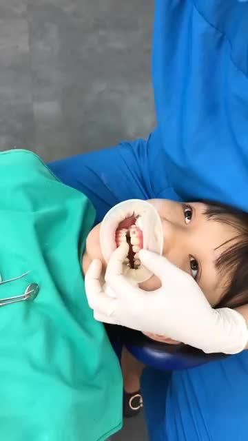 Những chia sẻ của bác sĩ Hoà và quá trình gắn mắc cài kim loại tự động cho bệnh nhân tại Shinbi Dental