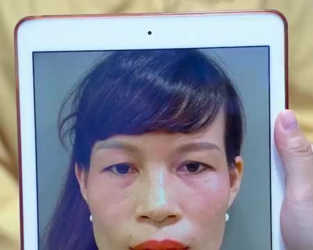 SAU BAO NGÀY CHỜ ĐỢI, CUỐI CÙNG CŨNG SỞ HỮU ĐÔI MẮT TRẺ TRUNG NHƯ MONG ƯỚC.