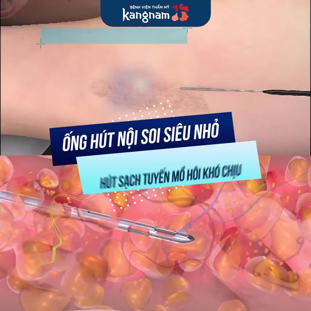 ENDO DRY - bye bye HÔI NÁCH