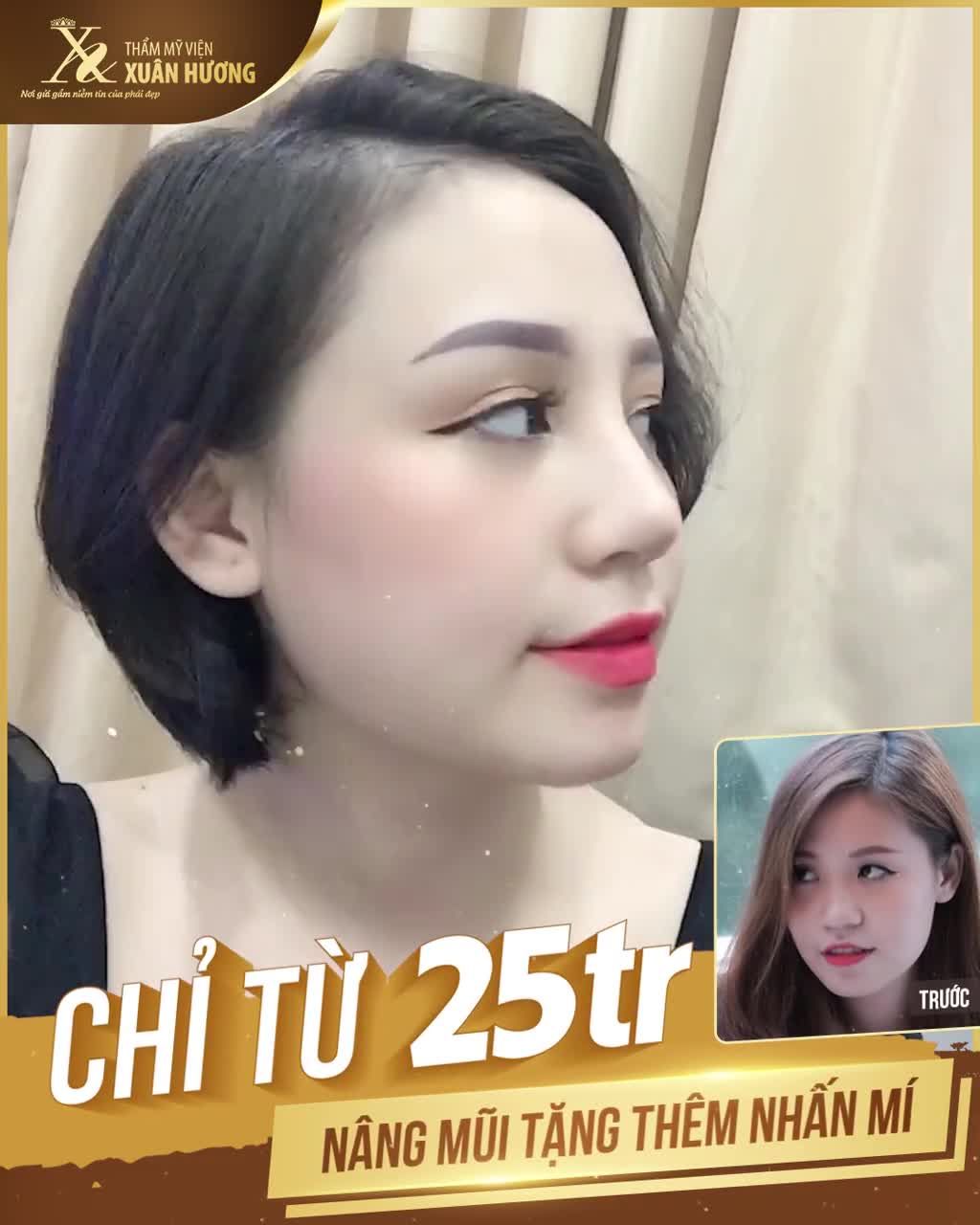 NÂNG MŨI LẠI TẶNG THÊM NHẤN MÍ CHỈ TỪ 25 TRIỆU