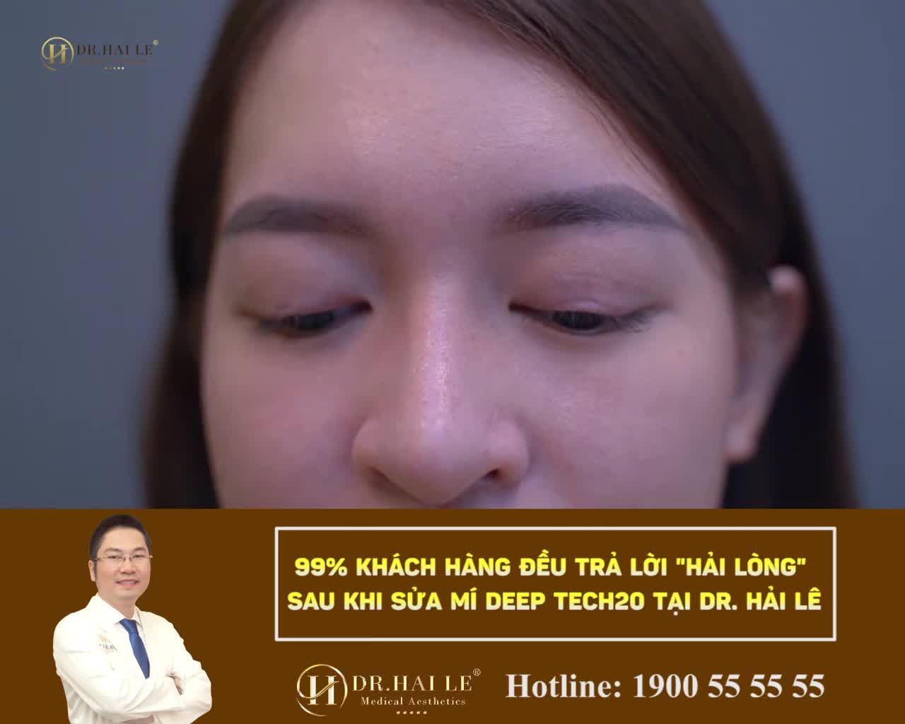 "HỒI SINH" MÍ XẤU HỎNG TẠI VTM DR.HẢI LÊ - ĐẸP VÀ ĐẸP HƠN NỮA!