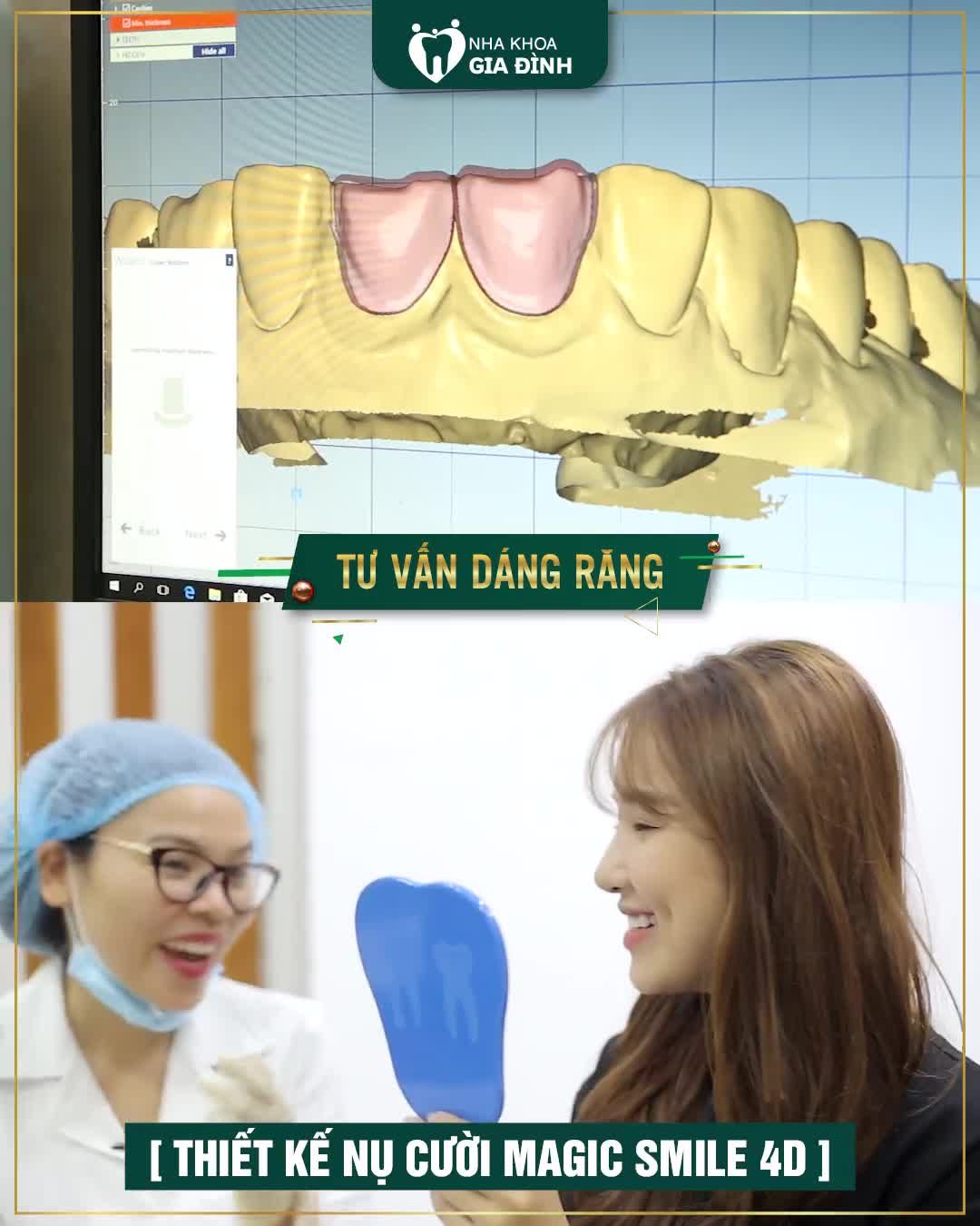 THẨM MỸ RĂNG SỨ CAO CẤP – TĂNG ĐỘ BỀN CHẮC GẤP NHIỀU LẦN RĂNG THẬT