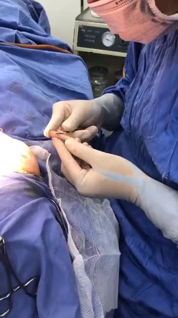 Đột nhập phòng mổ xem cận cảnh quá trình Nâng mũi Cấu trúc 4D cùng bác sĩ Kangnam