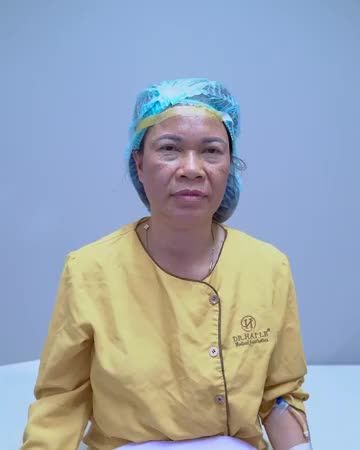 MẮT SỤP MÍ, NHIỀU DA CHÙNG M.Ỡ THỪA KHIẾN BẠN "GIÀ" HƠN TUỔI THẬT!