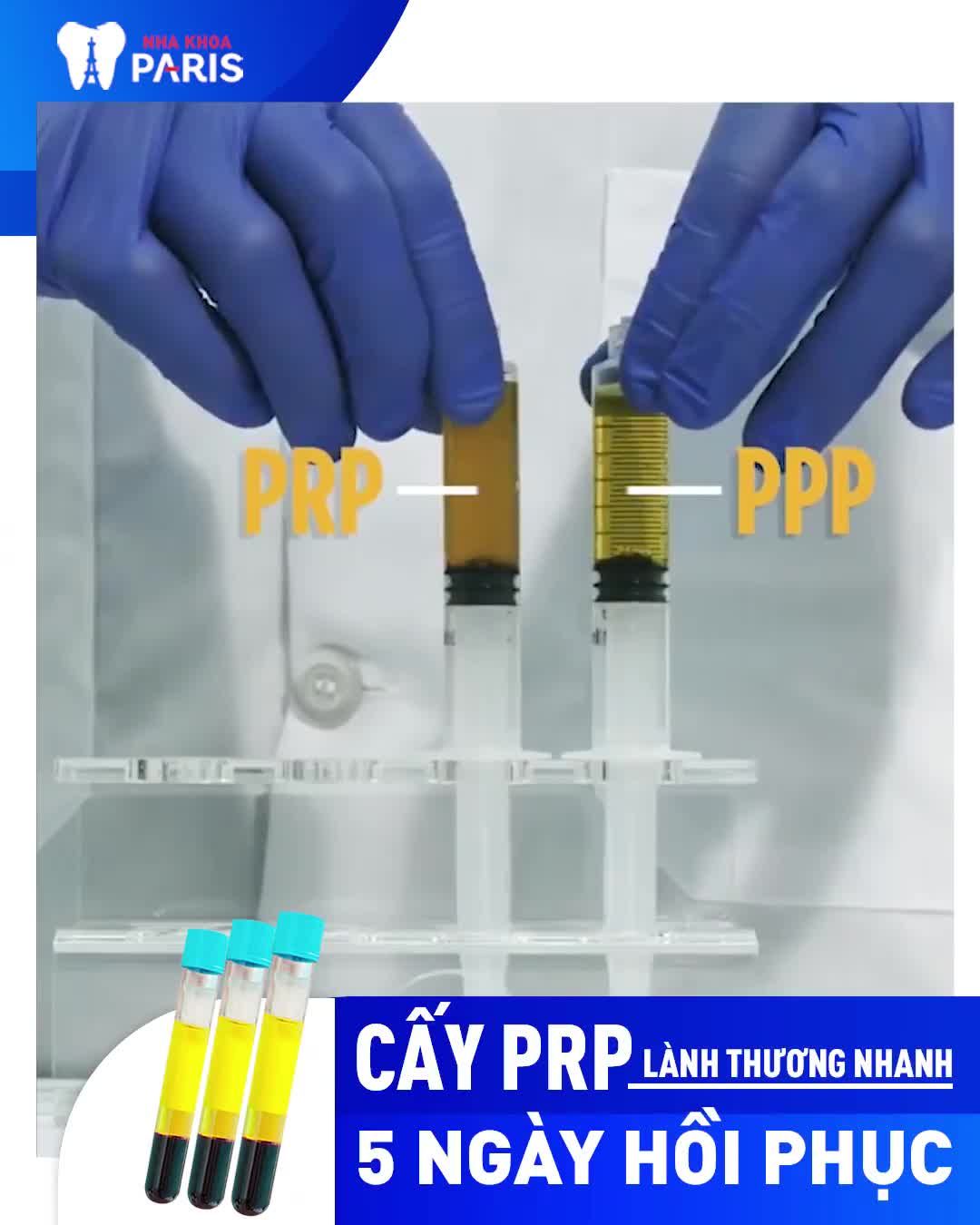 Cười Đẹp Ăn Ngon Sợ Gì Răng Mất