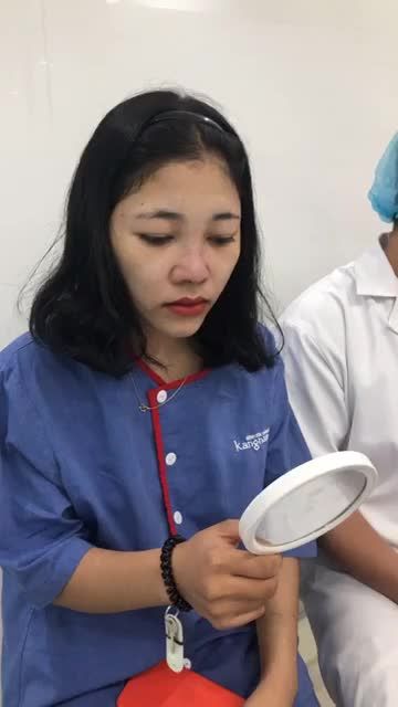 Lột xác cho cô gái người Lào cùng dịch vụ Nâng mũi cấu trúc 4D của bác sĩ Kangnam
