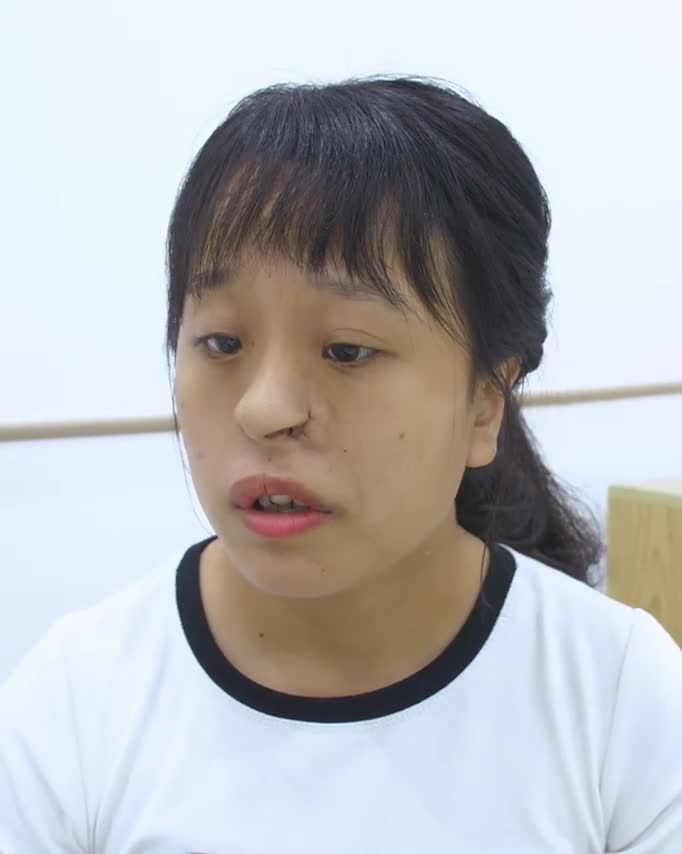 Ca mũi dị tật bẩm sinh có làm khó bác sĩ Đông Á!?