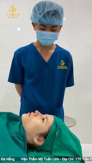 Cuối tuần tại thẩm mỹ Tuấn Linh Khách hàng thực hiện COMBO nâng mũi cấu trúc Kết hợp độn cằm Plassma.
