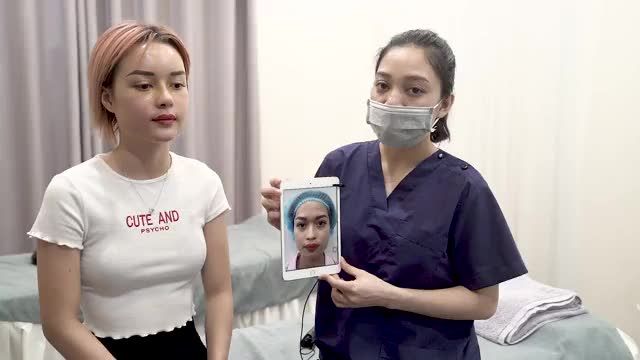 KHÁCH HÀNG CỰC XINH thực hiện Combo Nâng Mũi + Cấy Mỡ Bio Nano sau 5 ngày bóc băng