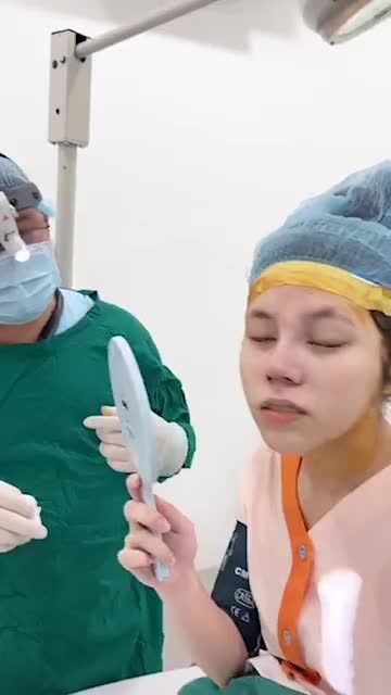 Khách hàng đã nâng mũi chỉ được 1 năm, lệch vách ngăn, sóng mũi thấp, đầu mũi to va ngắn.