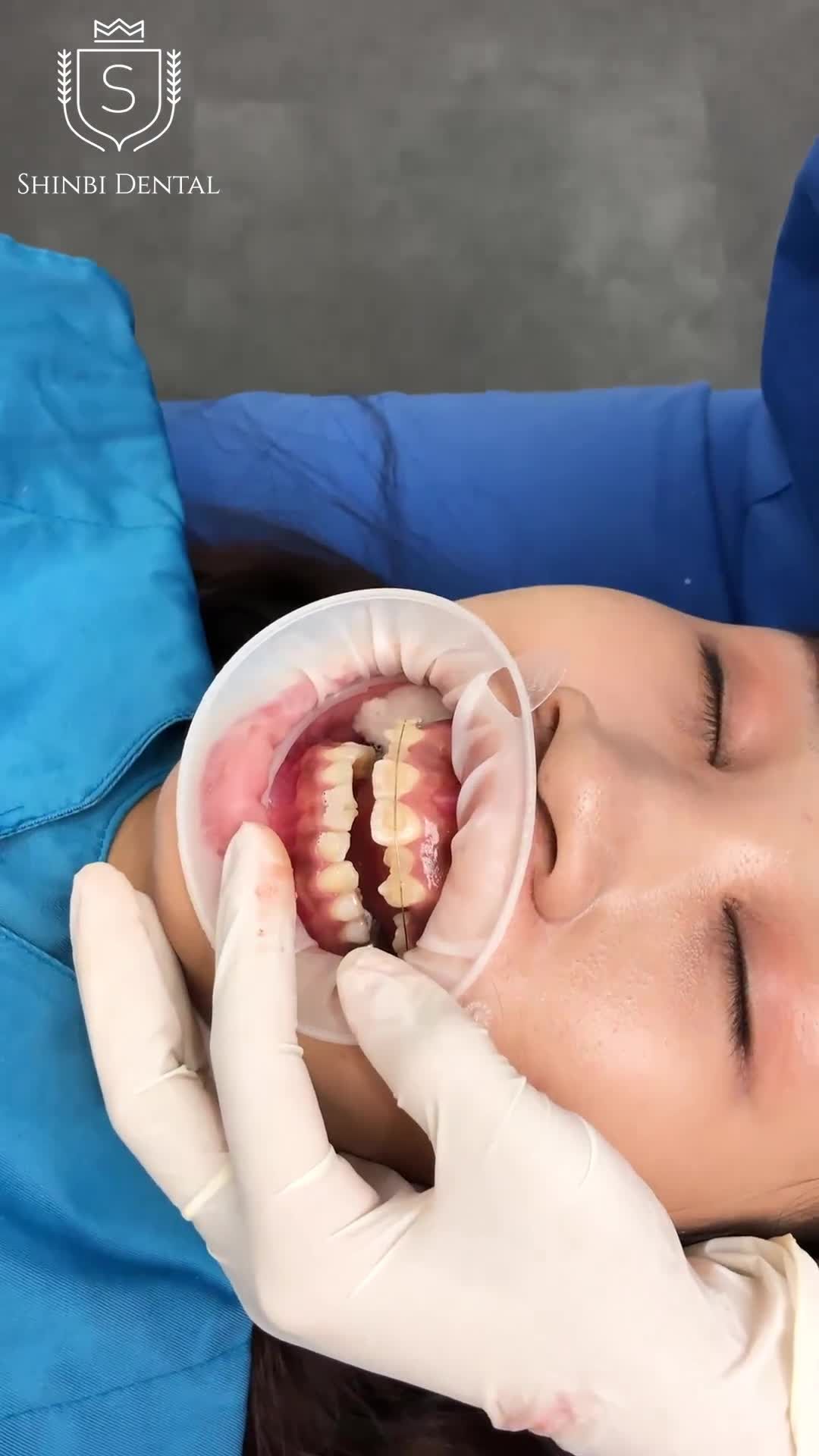 Một chiều làm việc năng suất của bác sĩ Hòa - chuyên khoa răng hàm mặt Đại học Y Hà Nội
